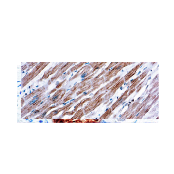 Actinin Actinin