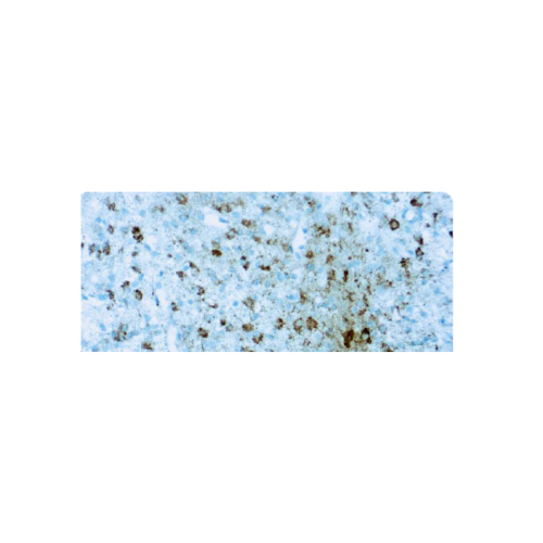 Anti-Isocitrate Dehydrogenase 1