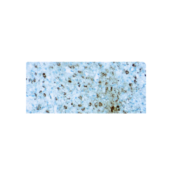 Anti-Isocitrate Dehydrogenase 1 Anti-Isocitrate Dehydrogenase 1