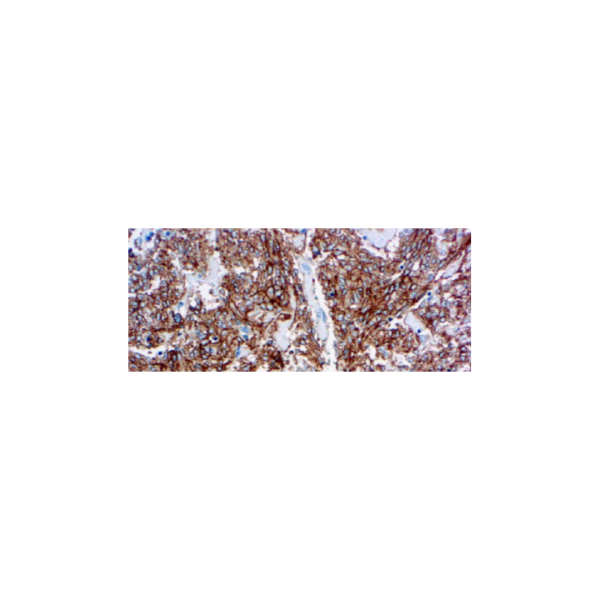 CD117 c-kit CD117 c-kit