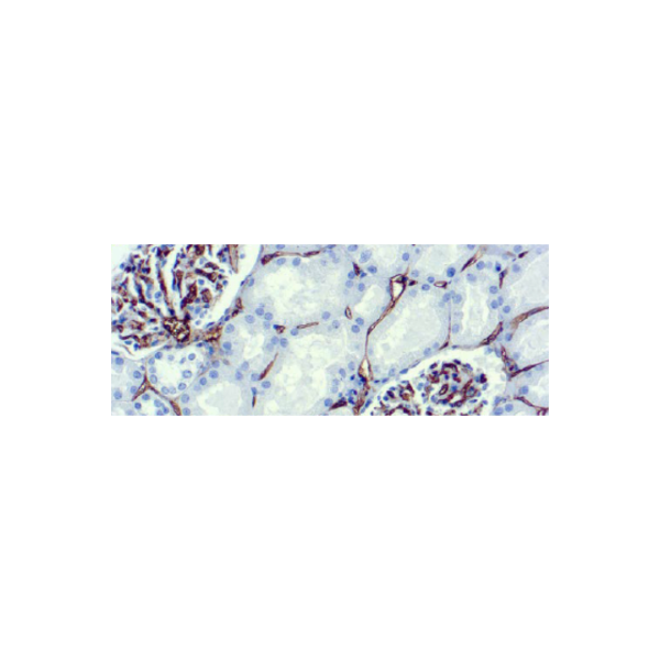 CD34, Célula Endotelial CD34, Célula Endotelial