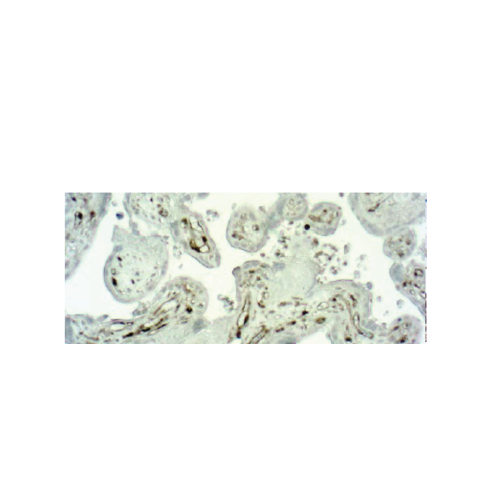 Caspase 1