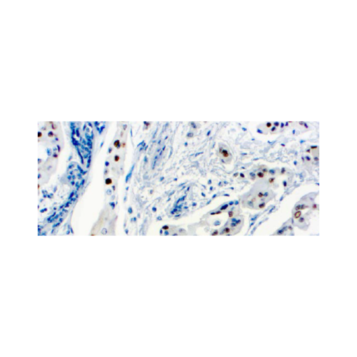 Ciclina D1 (SP4) Ciclina D1 (SP4)