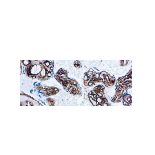 Collagen Type IV