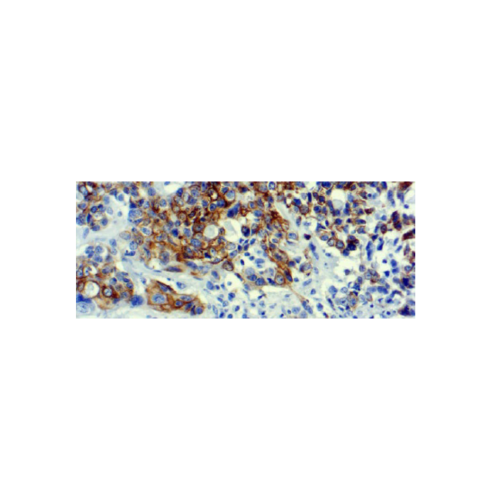 Cytokeratin 7 (LP1K) Cytokeratin 7 (LP1K)