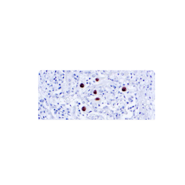 Cytomegalovirus