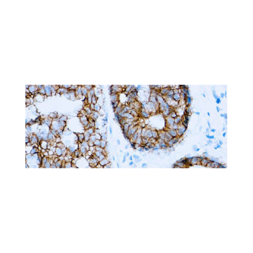 E-Cadherin E-Cadherin