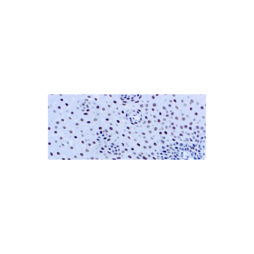 ERCC1 ERCC1