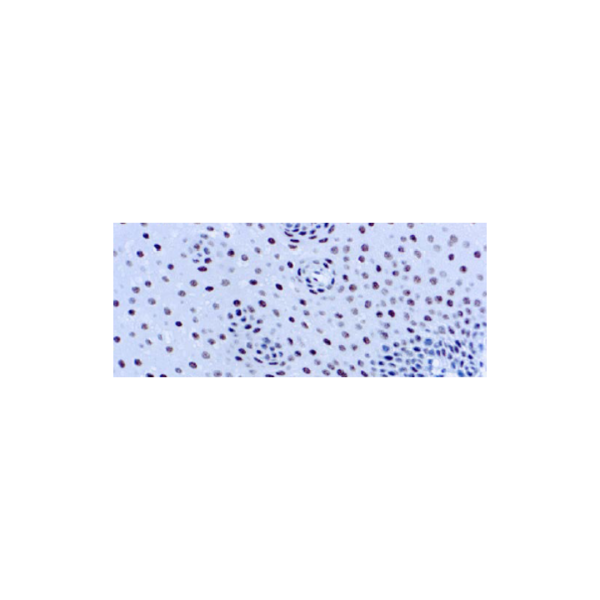 ERCC1 ERCC1
