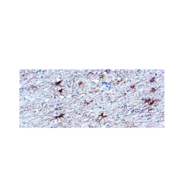 Glial Fibrillary Acidic Protein (GFAP) Glial Fibrillary Acidic Protein (GFAP)