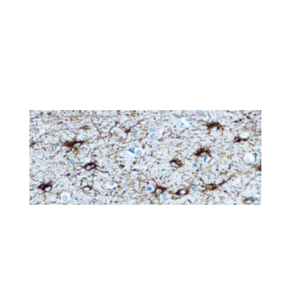 Glial Fibrillary Acidic Protein (GFAP) Anticuerpo monoclonal de Conejo