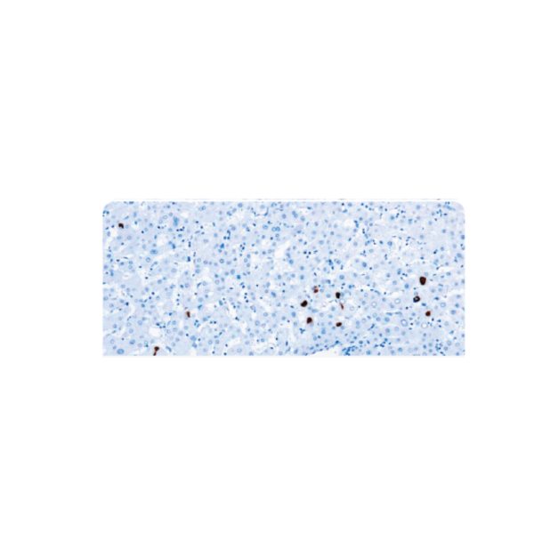 Hepatitis B Surface Antigen Hepatitis B Surface Antigen