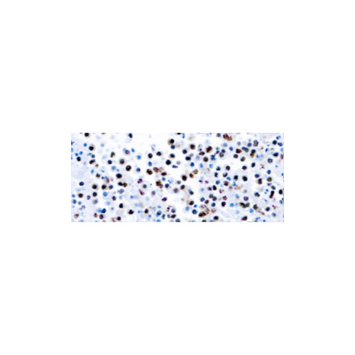 Herpesvirus 8 (HHV8)