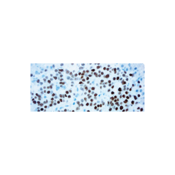 INSM1 (A-8) INSM1 (A-8)