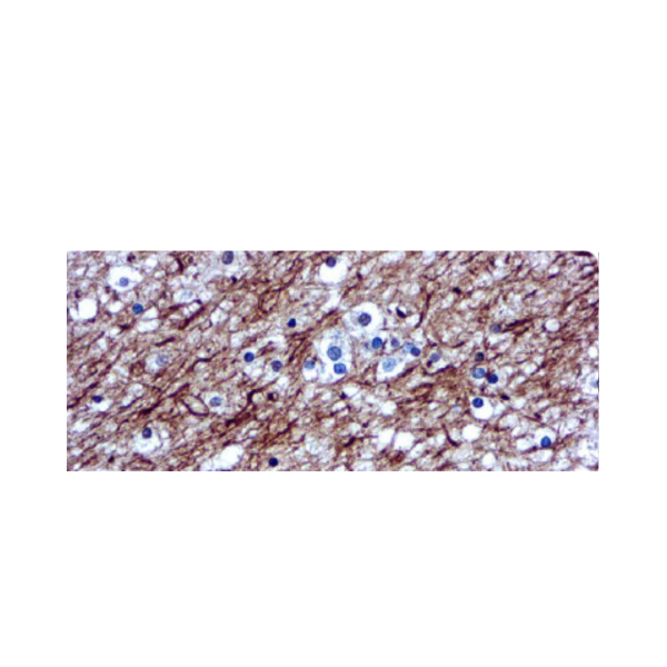 Neurofilamentos Neurofilamentos