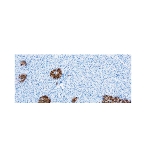 Neuron Specific Enolase