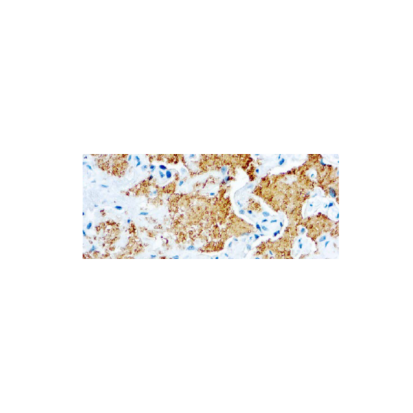 Pneumocystis Pneumocystis