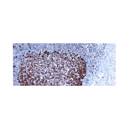 Proliferating Cell Nuclear Antigen (PCNA) (PC10) Proliferating Cell Nuclear Antigen (PCNA) (PC10)