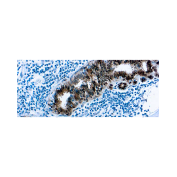 Proteína de Choque Térmico 70 (HSP 70) (W27) Proteína de Choque Térmico 70 (HSP 70) (W27)