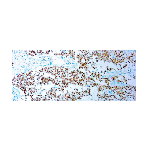 SALL4 (6E3) SALL4 (6E3)