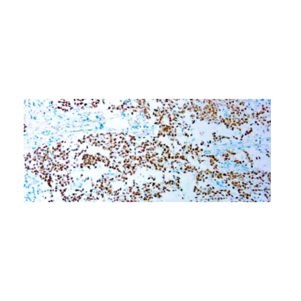 SALL4 (6E3) SALL4 (6E3)