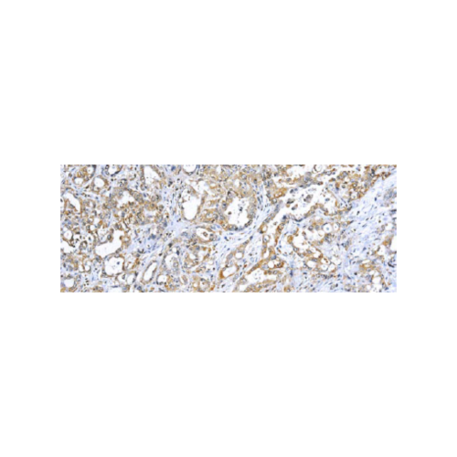 TNF-alpha (Tumor Necrosis Factor alpha)