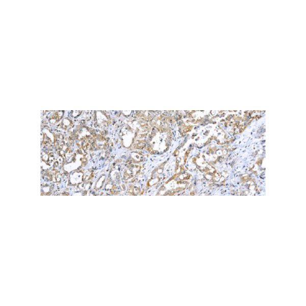 TNF-alpha (Tumor Necrosis Factor alpha) TNF-alpha (Tumor Necrosis Factor alpha)