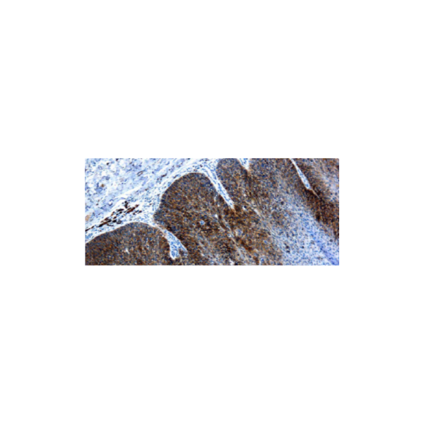 VPH 16 VPH 16