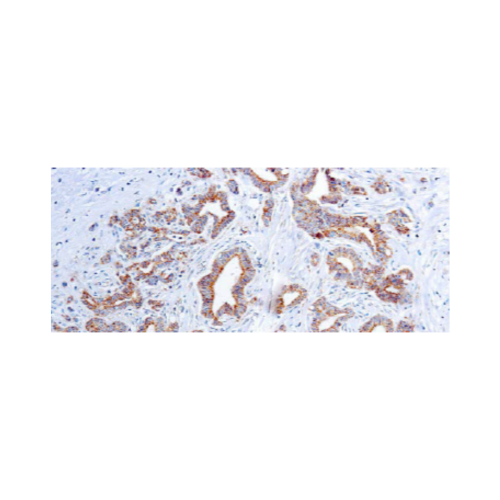 Vascular Endothelial Growth Factor Vascular Endothelial Growth Factor