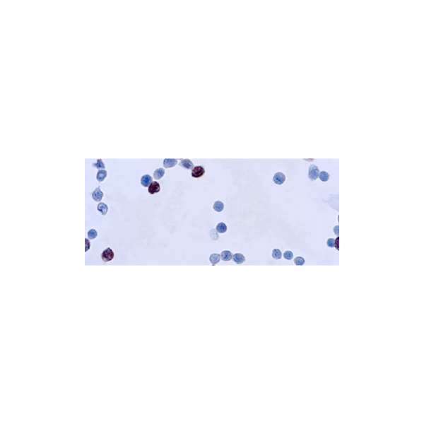 adenovirus adenovirus