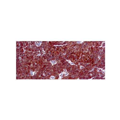 Adipophilin Adipophilin