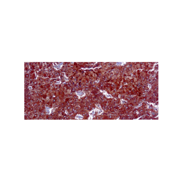 Adipophilin Adipophilin