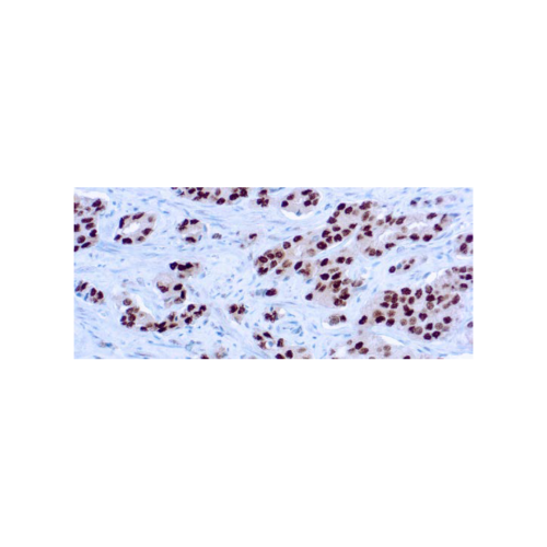 Androgen Receptor Androgen Receptor