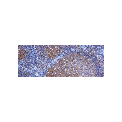 Bcl-10 Bcl-10
