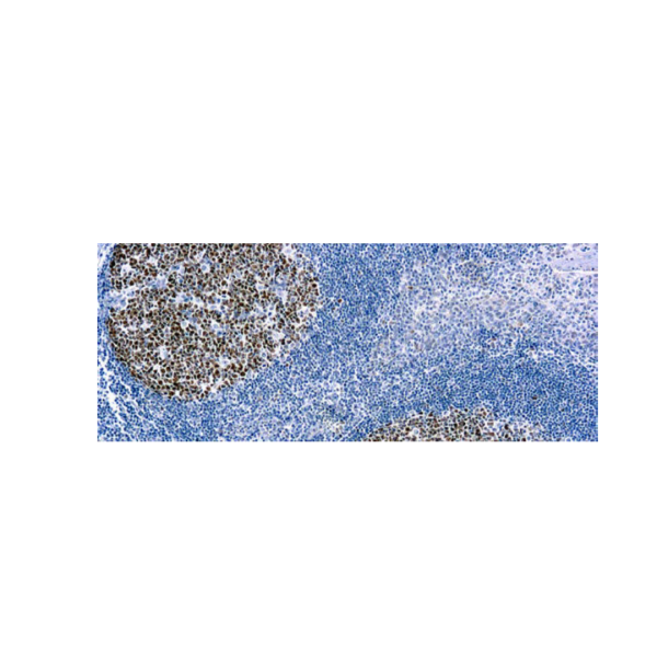 Bcl-6 (PG-B6) Bcl-6 (PG-B6)