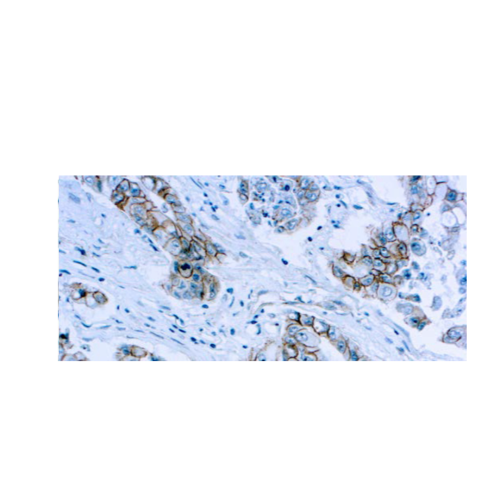 Beta-Catenin Beta-Catenin
