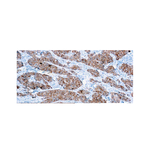 CA15-3 CA15-3
