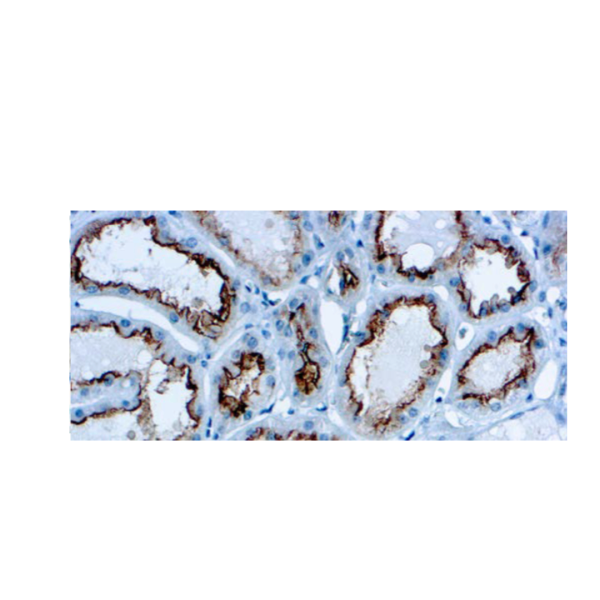 CD10 (EP195)