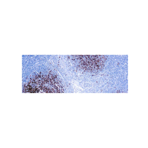 CD23 (SP23) CD23 (SP23)