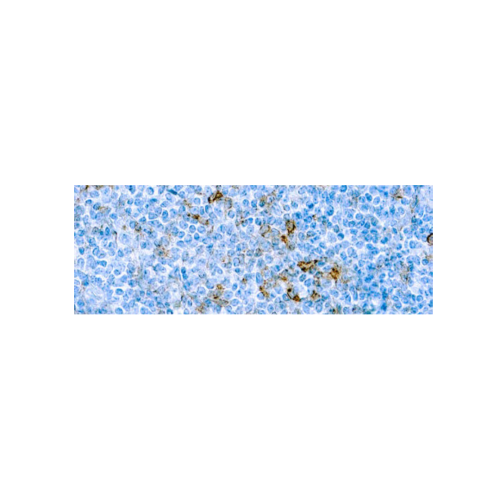 CD25IL‐2R α CD25IL‐2R α