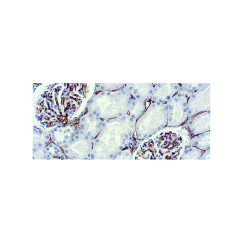 CD34, Célula Endotelial CD34, Célula Endotelial