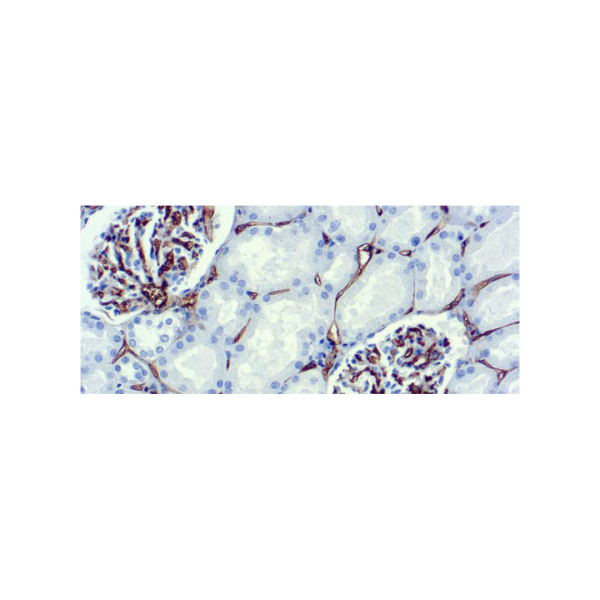 CD34, Célula Endotelial