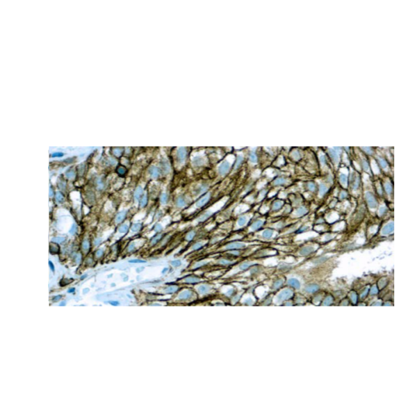 CD44HCAM CD44HCAM