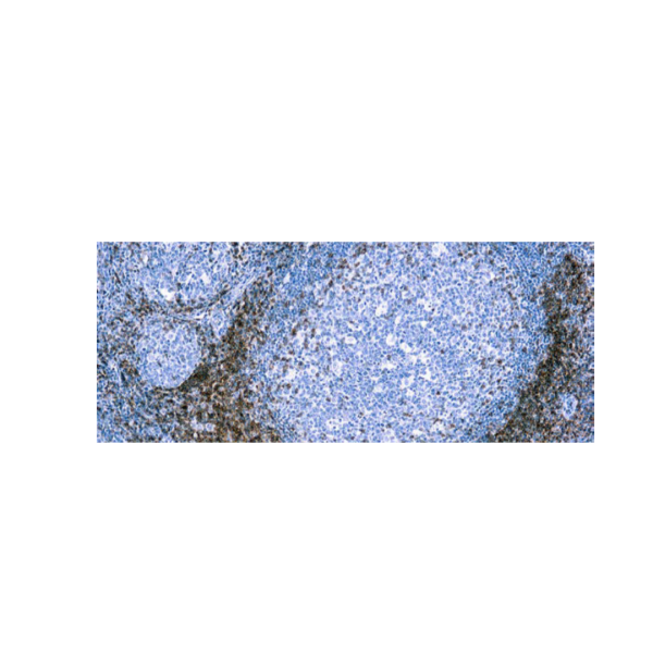 CD5 (CD554F6) CD5 (CD554F6)