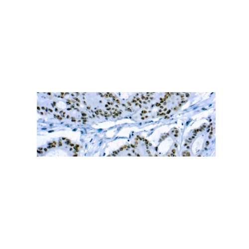 CD56Neural Cell Adhesion Molecule-1 CD56Neural Cell Adhesion Molecule-1