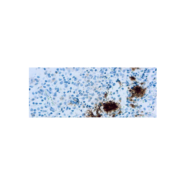 CD61Glycoprotein IIIa plaquetas CD61Glycoprotein IIIa plaquetas