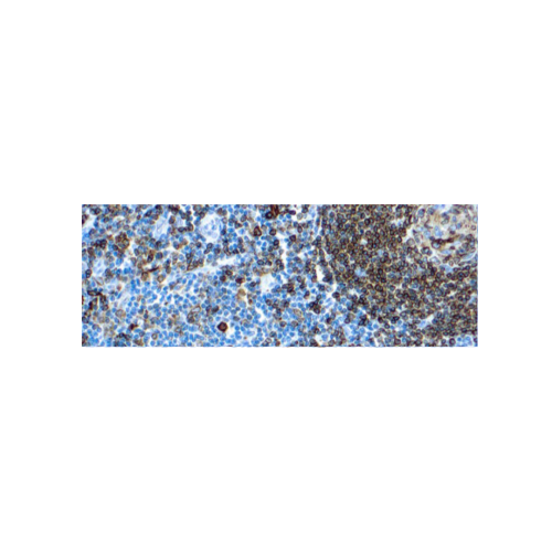 CD74, Marcador de linfoides CD74, Marcador de linfoides