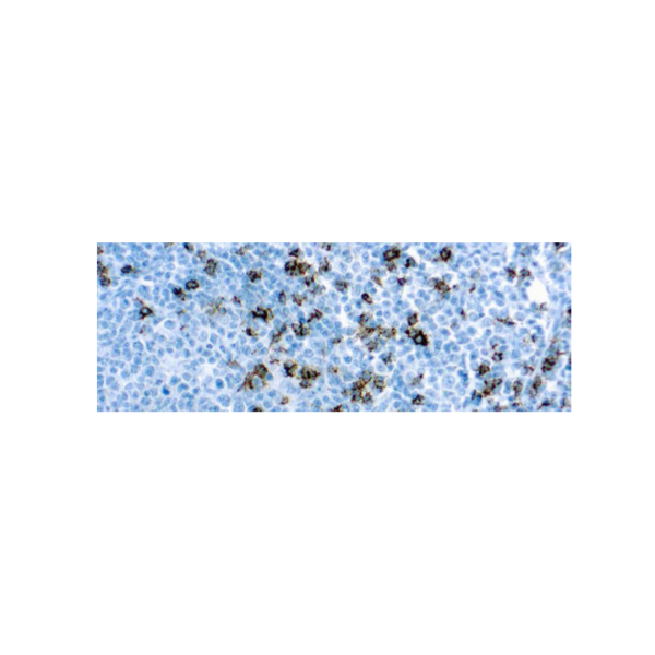 CD8, T Cell CD8, T Cell
