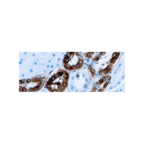 Calbindina-D-28K Calbindina-D-28K