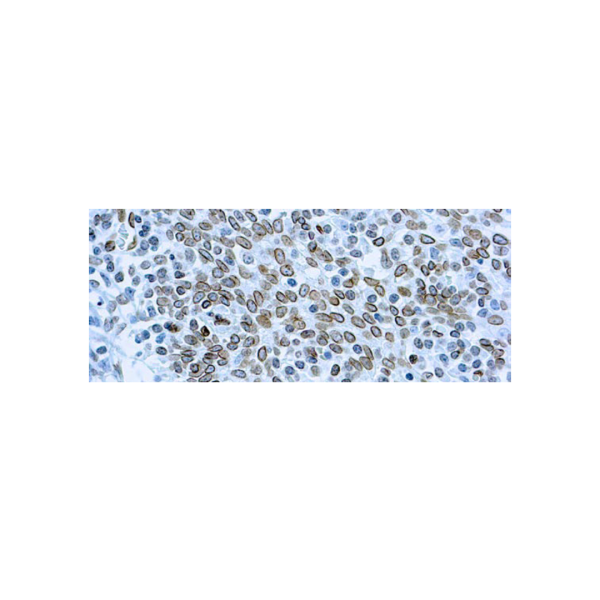 Cdc25A